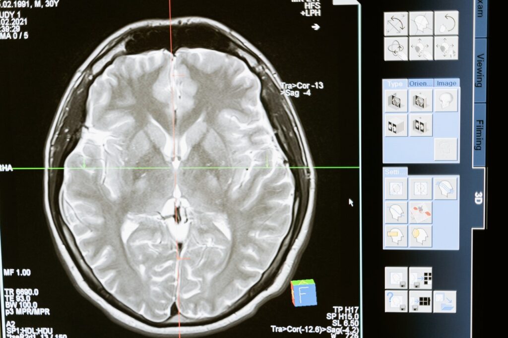 ¿Qué es la Neurofelicidad y Cuáles son sus Ventajas?