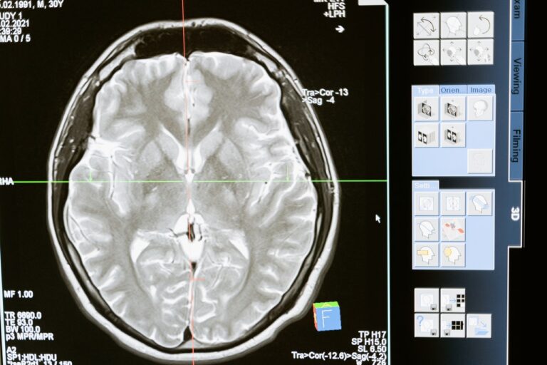 ¿Qué es la Neurofelicidad y Cuáles son sus Ventajas?